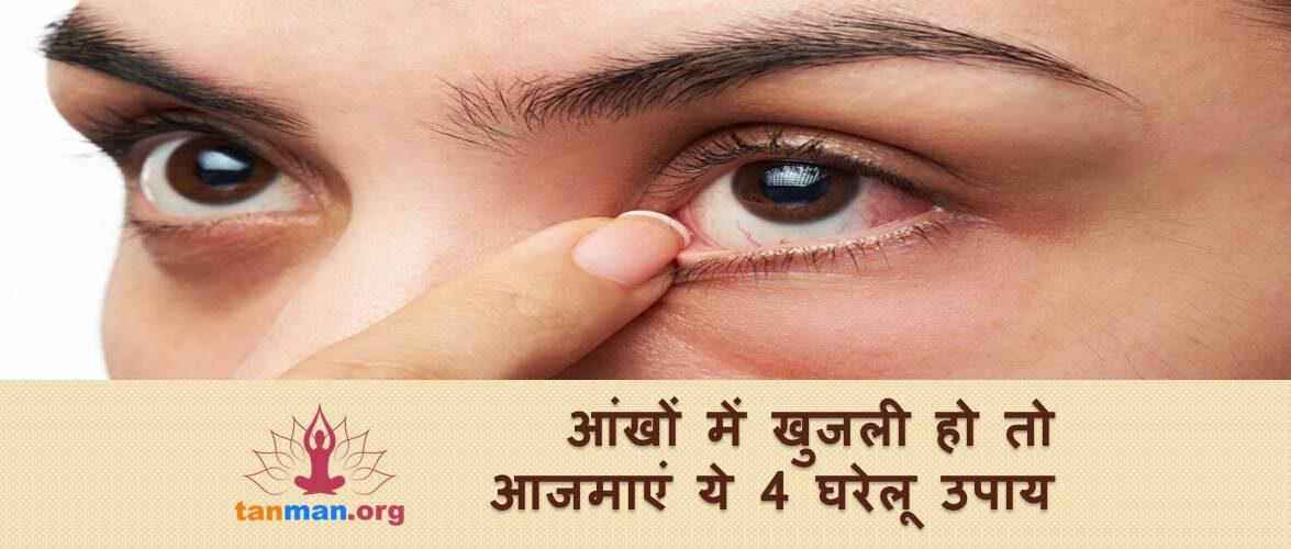 आंखों में खुजली हो रही हो तो आजमाएं ये 4 घरेलू उपाय