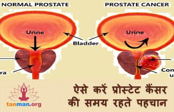 ऐसे करें प्रोस्टेट कैंसर की जल्द पहचान, ताकि नहीं जाए किसी की जान