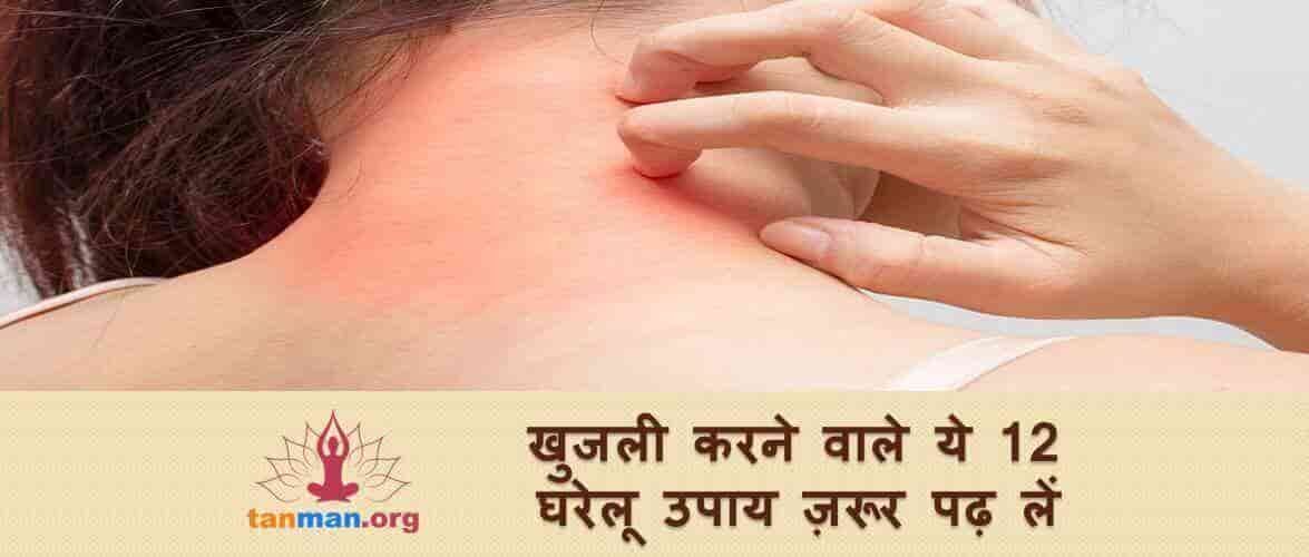 खुजली करने वाले इन 12 घरेलू उपायों को ज़रूर पढ़ लें