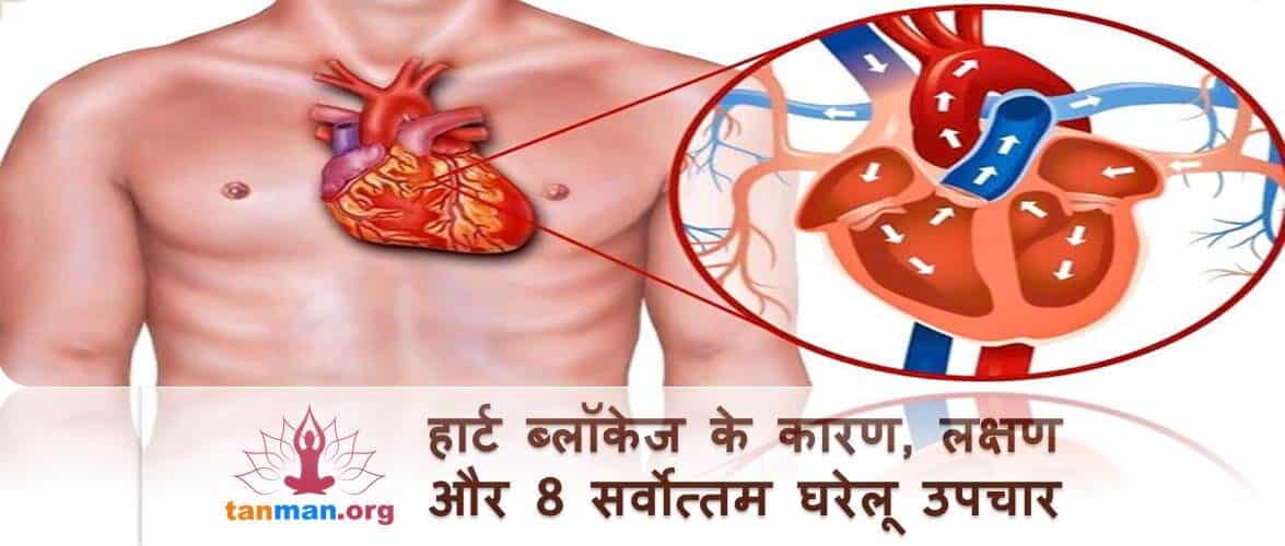 हार्ट ब्लॉकेज के कारण, लक्षण और टॉप 8 घरेलू उपचार