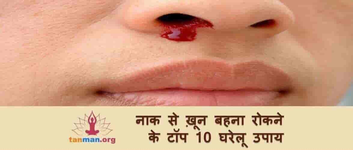 नाक से खून बहना रोकने के टॉप 10 घरेलू उपाय